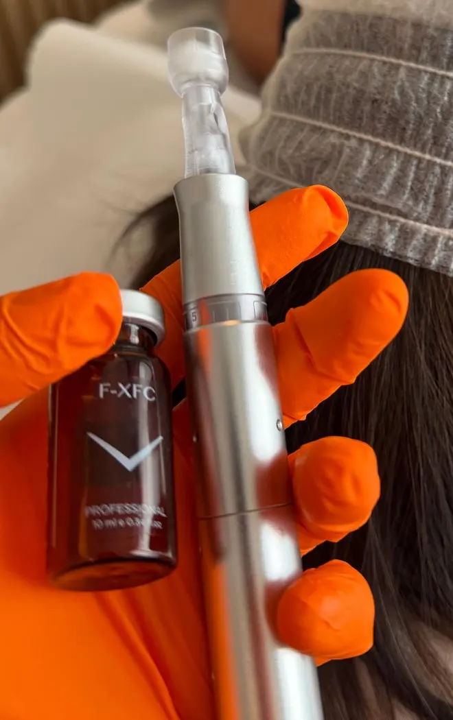Aplicatorul de microneedling Exceed și o fiolă de ser, ținute în mâna cu mănușă, în timpul unei ședințe