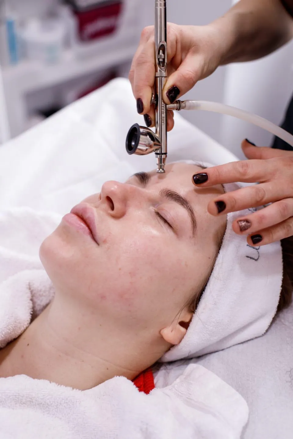 Aerograful de oxigen ținut deasupra frunții clientei, în timpul unui tratament facial